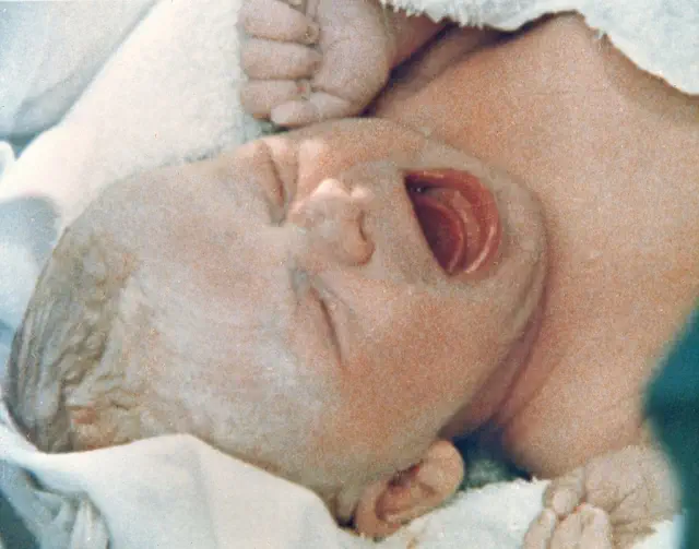 Newborn baby crying, wrapped in a soft blanket, with eyes closed and mouth open