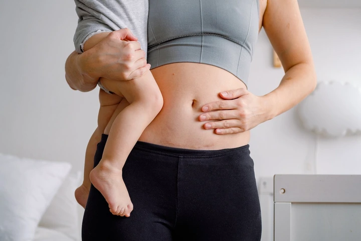 Close up of a belly with scar from c-section.