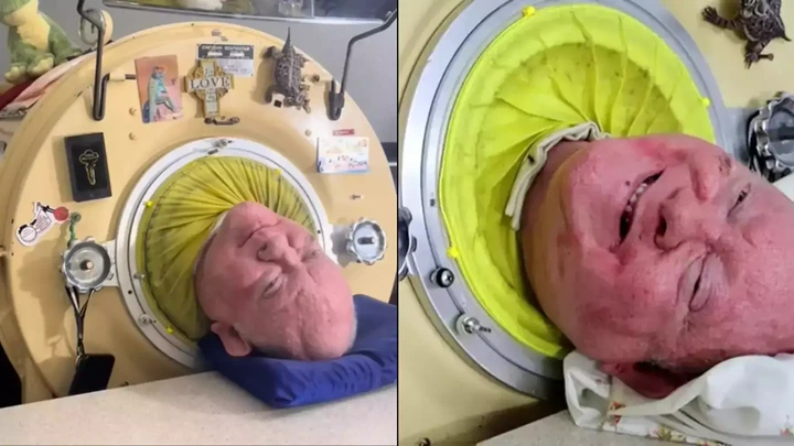 How man survived inside 'iron lung' for 70 years before dying last year